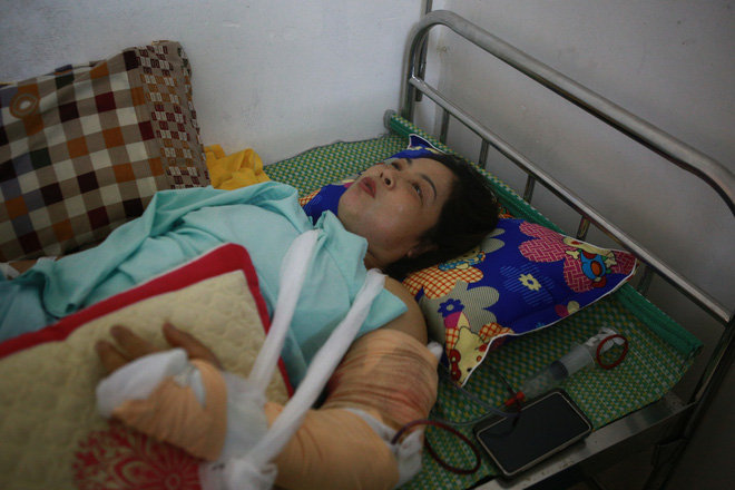 Tình hình sức khỏe của các nạn nhân bị thương trong vụ lốc xoáy ở Vĩnh Phúc: 2 bệnh nhân nặng bị gãy xương đùi, có biểu hiện sốc chấn thương-1