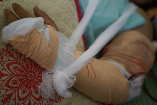 Tình hình sức khỏe của các nạn nhân bị thương trong vụ lốc xoáy ở Vĩnh Phúc: 2 bệnh nhân nặng bị gãy xương đùi, có biểu hiện sốc chấn thương-2