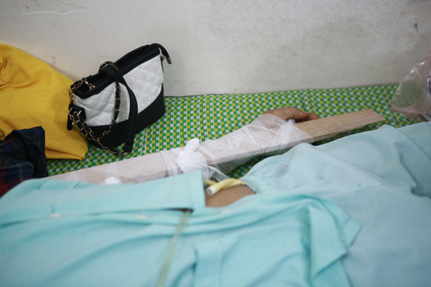 Tình hình sức khỏe của các nạn nhân bị thương trong vụ lốc xoáy ở Vĩnh Phúc: 2 bệnh nhân nặng bị gãy xương đùi, có biểu hiện sốc chấn thương-4
