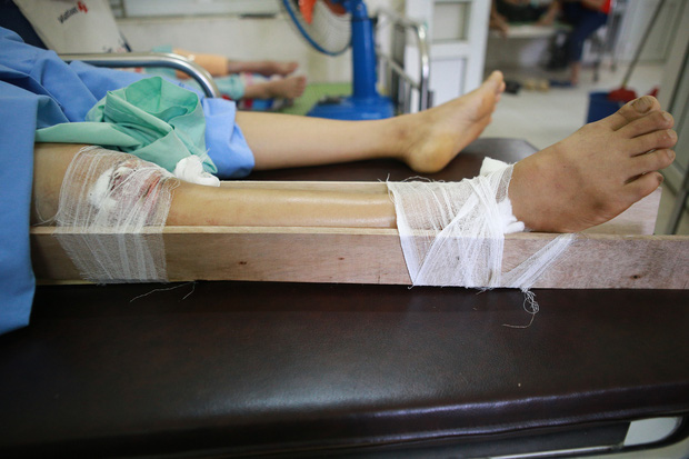 Tình hình sức khỏe của các nạn nhân bị thương trong vụ lốc xoáy ở Vĩnh Phúc: 2 bệnh nhân nặng bị gãy xương đùi, có biểu hiện sốc chấn thương-6