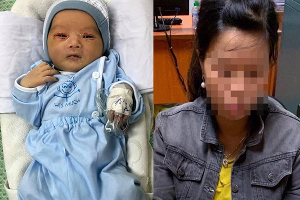 Bác sĩ cứu sống cháu bé bị bỏ rơi ở hố ga giữa trời nắng 40 độ bật khóc: Đến bây giờ bọn mình vẫn sốc, nhấc chiếc áo đầu tiên ra mình thấy con ấu trùng đầu tiên...-3