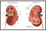 Đổ mồ hôi khi ngủ, dấu hiệu cảnh báo 4 bệnh nguy hiểm-2