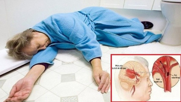 Căn bệnh sát thủ có thể gây suy tim, đột quỵ, suy thận: Nguy hiểm nhưng khó phát hiện-3