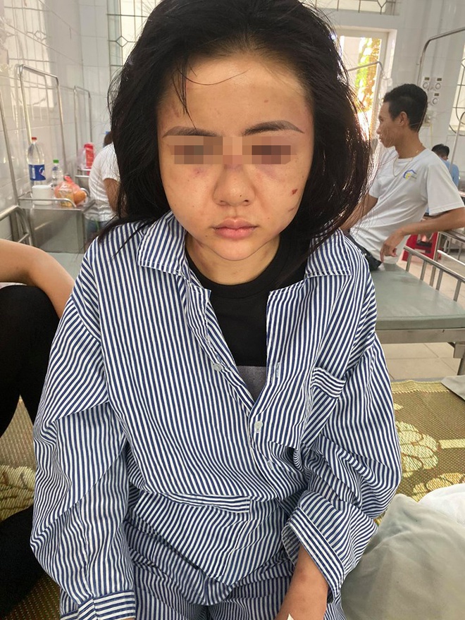 Gã trai đánh đập cô gái suốt 2 giờ vì không được đáp lại tình cảm-1