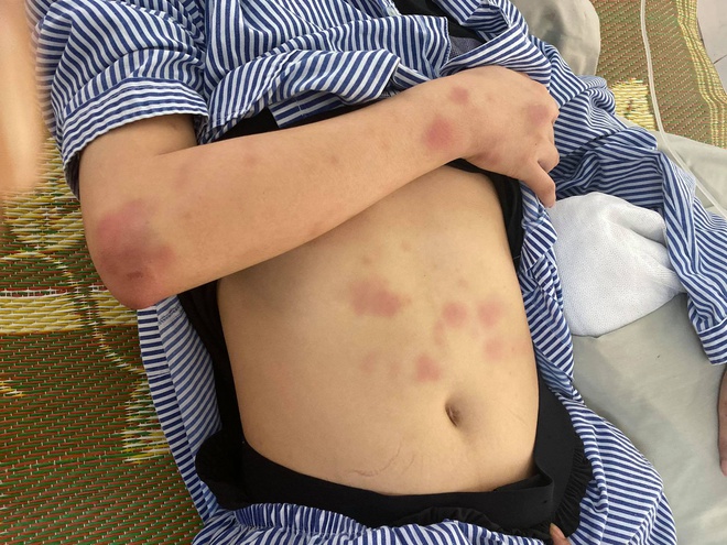 Gã trai đánh đập cô gái suốt 2 giờ vì không được đáp lại tình cảm-2
