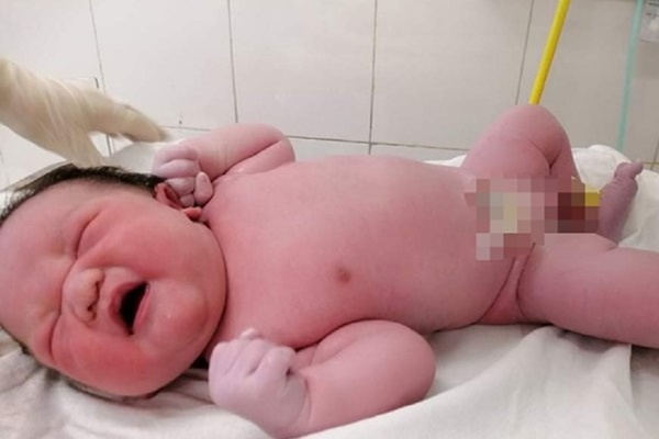 Bé sơ sinh nặng gần 5.4kg chào đời ở Hà Nội-1