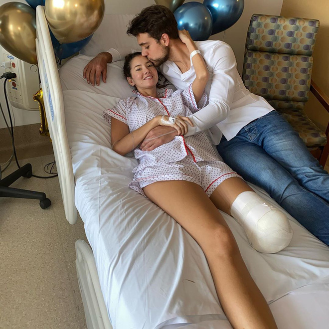 Xót xa nụ cười lạc quan cùng hình ảnh sắc vóc đỉnh cao của Hoa hậu Colombia bị cưa chân trái vì biến chứng phẫu thuật-5