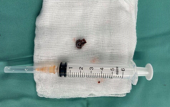 Đại ca giang hồ đất Cảng bị bắn ở quán nước-3