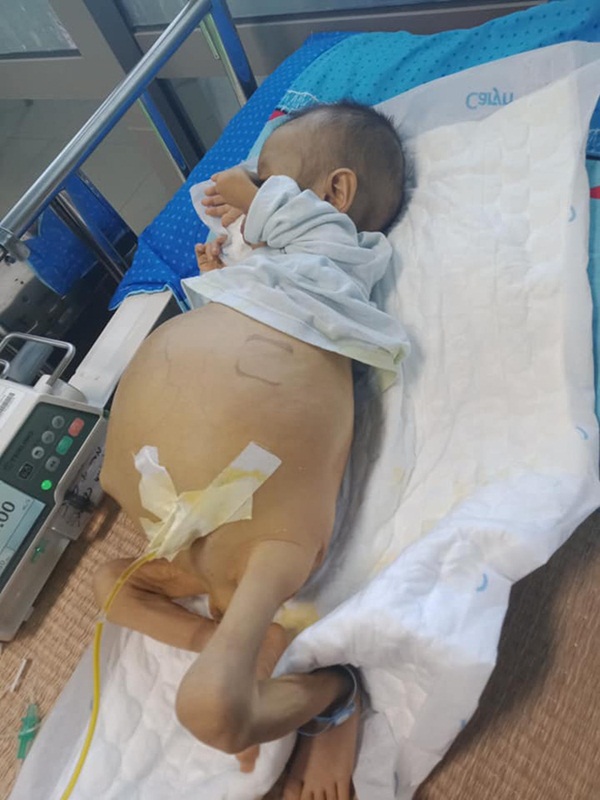 Bức thư đẫm nước mắt của người cha là giáo viên gửi con trai 9 tháng tuổi, cái bụng chực nổ tung vì căn bệnh hiểm nghèo-2