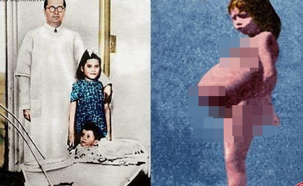 Bụng cô bé 5 tuổi ngày một phình to, bố mẹ tưởng khối u nhưng sự thật khiến cả thế giới sửng sốt, cảnh sát phải lập tức vào cuộc-1