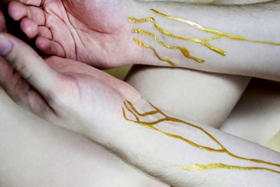Cách giữ mạng sống của người đàn ông mang nhóm máu 'quý hơn vàng'