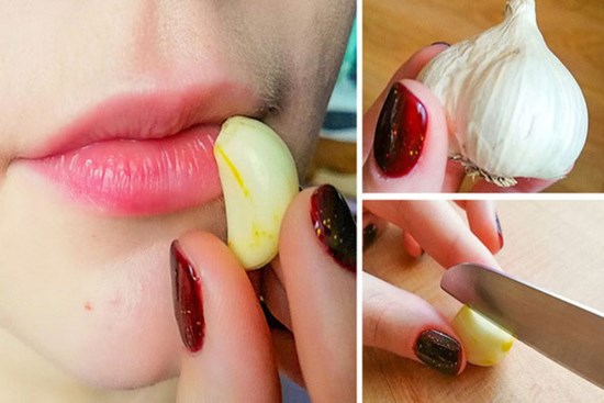 8 cách đơn giản trị bệnh lở miệng hiệu quả