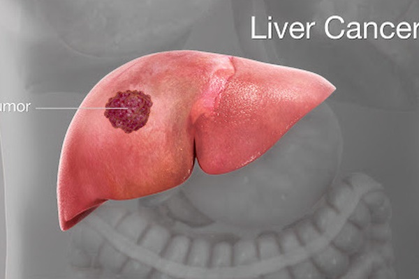 Đừng để trẻ ăn sáng bằng 4 món này vì có thể gieo mầm nhiều bệnh nguy hiểm, bao gồm cả ung thư-5