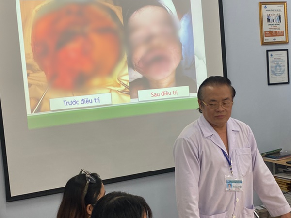 Thương tâm: Đang ăn xúc xích, cháu bé 17 tháng tuổi bị chó hàng xóm ngoạm nát mặt-1