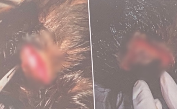 Thương tâm: Đang ăn xúc xích, cháu bé 17 tháng tuổi bị chó hàng xóm ngoạm nát mặt-3