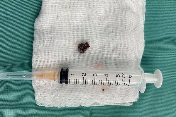 Đại ca giang hồ đất Cảng bị bắn gục: Hé lộ hình ảnh sát thủ chĩa súng từ trong xe ô tô-3