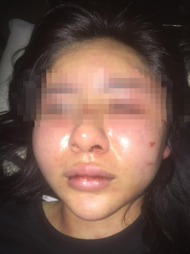 Vụ gã đàn ông xăm trổ tra tấn cô gái suốt 2 tiếng đồng hồ trong nhà: Công an lên tiếng-1
