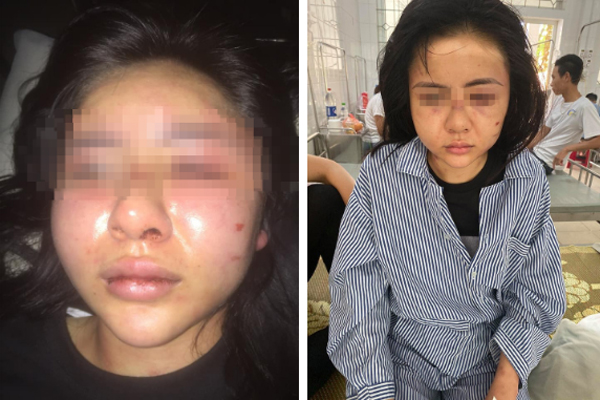 Lời kể kinh hoàng của cô gái bị gã trai xăm trổ đánh 2 tiếng vì từ chối tình cảm-3