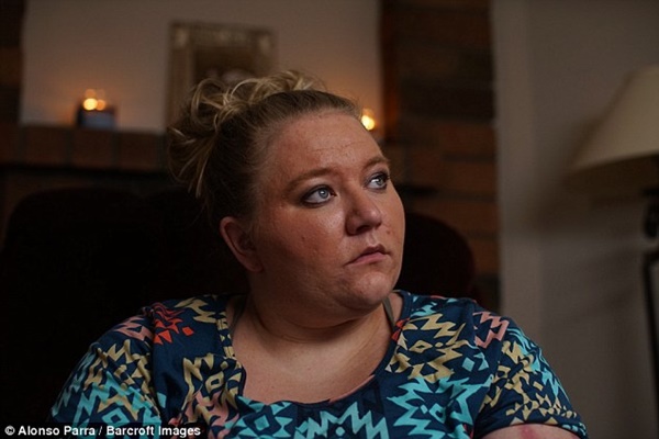 Người phụ nữ mắc căn bệnh đau đớn nhất thế giới-1