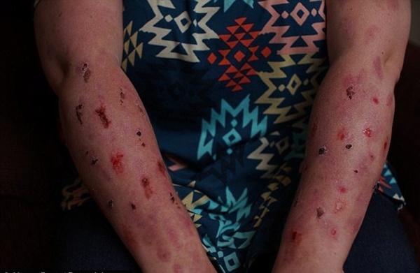 Người phụ nữ mắc căn bệnh đau đớn nhất thế giới-2