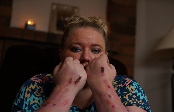 Người phụ nữ mắc căn bệnh đau đớn nhất thế giới-3