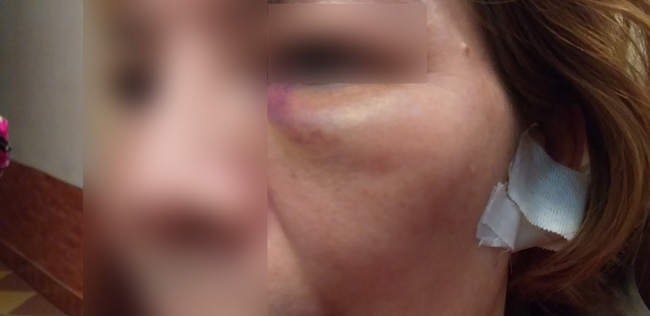 Nỗi ám ảnh của nữ chủ nhà sau trận đòn thừa sống thiếu chết của 8 người hàng xóm: Do mâu thuẫn miếng đất sau nhà-1