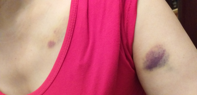 Nỗi ám ảnh của nữ chủ nhà sau trận đòn thừa sống thiếu chết của 8 người hàng xóm: Do mâu thuẫn miếng đất sau nhà-3