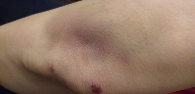 Nỗi ám ảnh của nữ chủ nhà sau trận đòn thừa sống thiếu chết của 8 người hàng xóm: Do mâu thuẫn miếng đất sau nhà-4