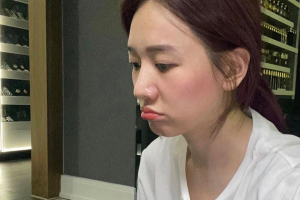 Bỏ đi lớp makeup đậm, không ít sao Hàn gây ngã ngửa với làn da đen nhẻm, sần sùi lấm tấm mụn-13