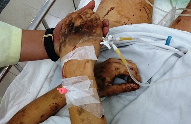 Trải lòng của người vợ Việt kiều Canada bị tạt axit, cắt gân chân: Mỗi lần chồng phải vào phòng phẫu thuật là một lần mình rơi nước mắt-1