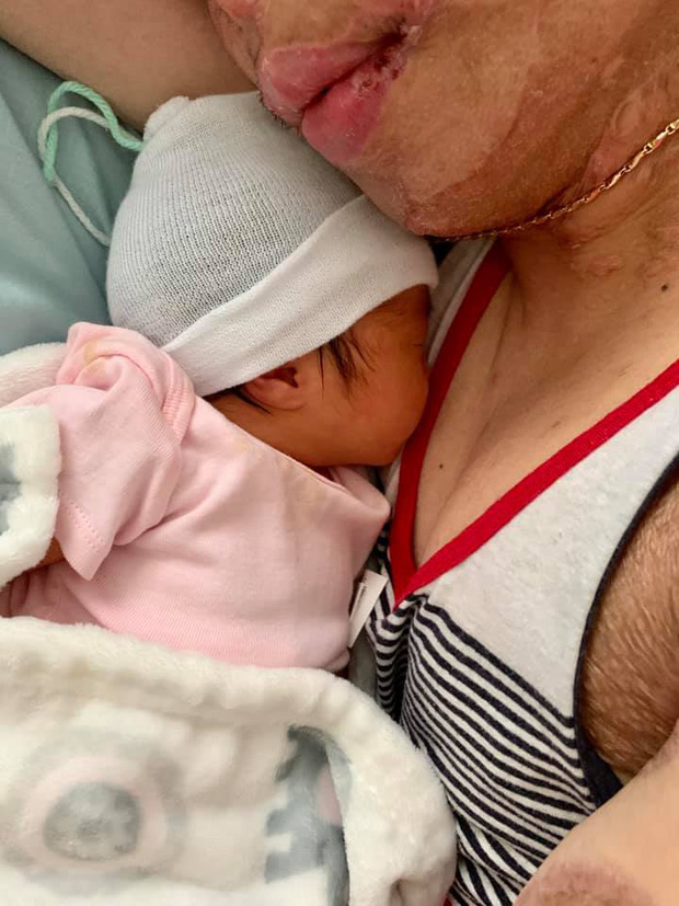 Trải lòng của người vợ Việt kiều Canada bị tạt axit, cắt gân chân: Mỗi lần chồng phải vào phòng phẫu thuật là một lần mình rơi nước mắt-11