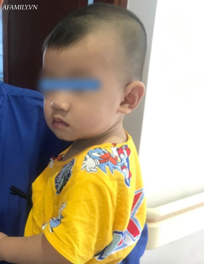 Tai nạn kinh hoàng: Mẹ đi pha sữa cho bú, bé trai 10 tháng tuổi bò xuống gầm bàn nuốt mảnh gương vỡ vào bụng-2