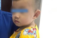Tai nạn kinh hoàng: Mẹ đi pha sữa cho bú, bé trai 10 tháng tuổi bò xuống gầm bàn nuốt mảnh gương vỡ vào bụng