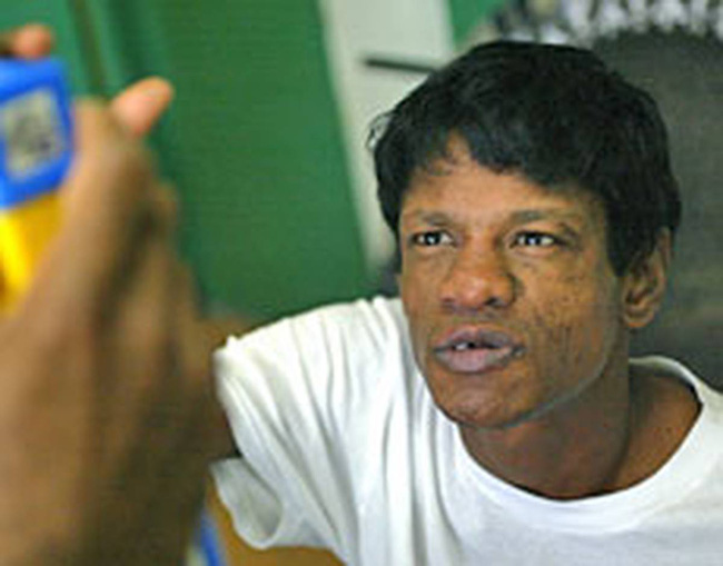 Chàng trai bị nhốt trong chuồng gà đến nỗi quên cách sống như con người và 22 năm bị cầm tù trên giường như động vật-3