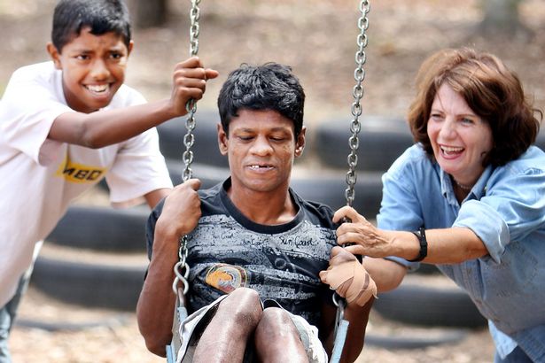 Chàng trai bị nhốt trong chuồng gà đến nỗi quên cách sống như con người và 22 năm bị cầm tù trên giường như động vật-5