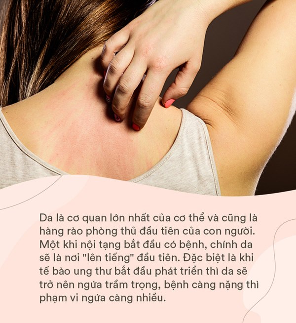 Da đang láng mịn bỗng mọc ra” 3 thay đổi bất thường này, hãy đi khám ngay bởi đó là dấu hiệu tế bào ung thư đang xâm lấn cơ thể-3