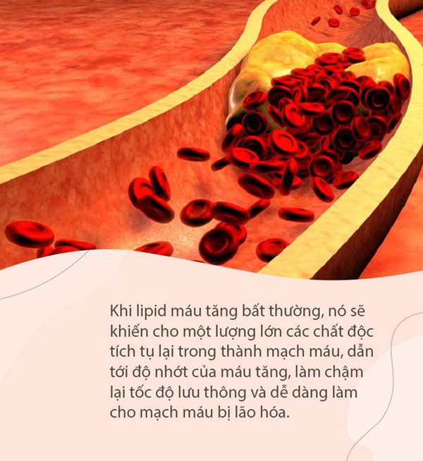 109 tuổi nhưng mạch máu của ông lão này như người ở tuổi 60: Bí quyết sống thọ của ông không cần tập thể dục mà là 3 điều này-2