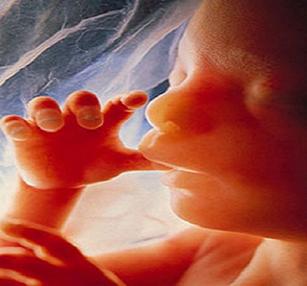 15 năm sau khi phá thai, bà mẹ choáng váng khi phát hiện con vẫn còn trong bụng và hiện tượng bào thai hóa đá hiếm gặp-3