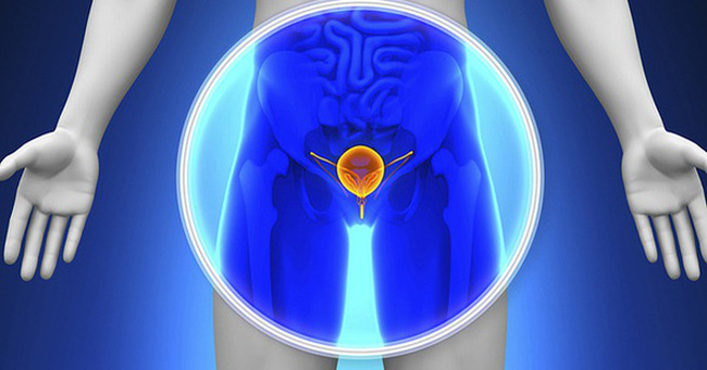 Đây là 7 loại ung thư gia đình nguy hiểm: Nếu trong nhà đang có người mắc thì con cái, họ hàng cần phải đi khám sớm để chặn đứng nguy cơ-5