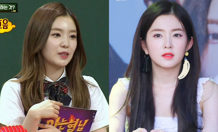 Bỏ đi lớp makeup đậm, không ít sao Hàn gây ngã ngửa với làn da đen nhẻm, sần sùi lấm tấm mụn-1
