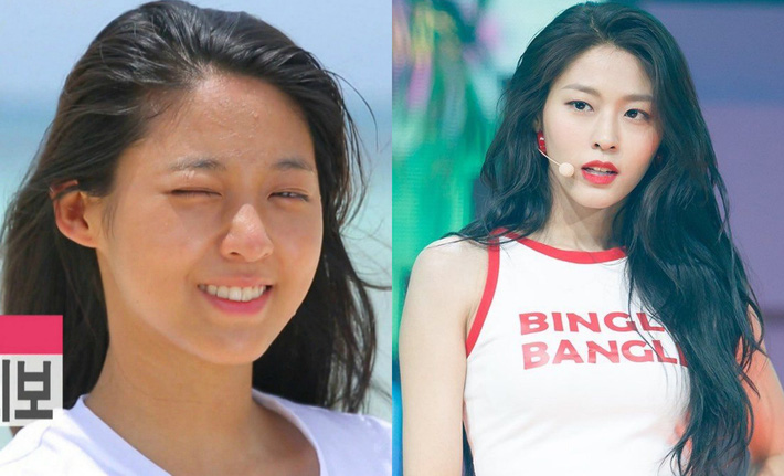 Bỏ đi lớp makeup đậm, không ít sao Hàn gây ngã ngửa với làn da đen nhẻm, sần sùi lấm tấm mụn-4