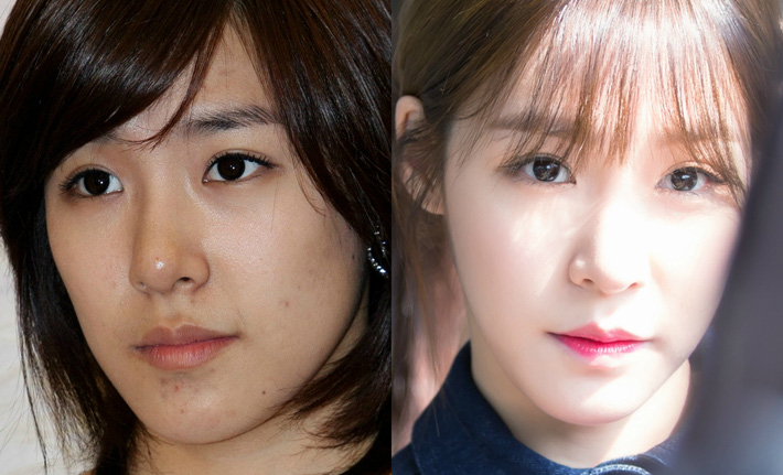 Bỏ đi lớp makeup đậm, không ít sao Hàn gây ngã ngửa với làn da đen nhẻm, sần sùi lấm tấm mụn-5