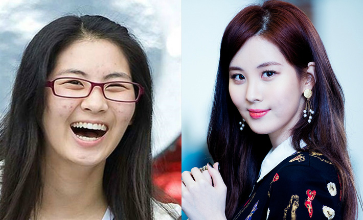 Bỏ đi lớp makeup đậm, không ít sao Hàn gây ngã ngửa với làn da đen nhẻm, sần sùi lấm tấm mụn-6