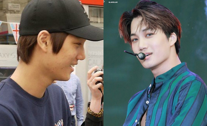 Bỏ đi lớp makeup đậm, không ít sao Hàn gây ngã ngửa với làn da đen nhẻm, sần sùi lấm tấm mụn-9