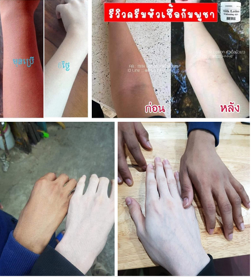Thái Lan đang lan truyền hộp kem tẩy trắng da: Biến da đen thành da như Cương Thi, trắng đến mức ám ảnh-2