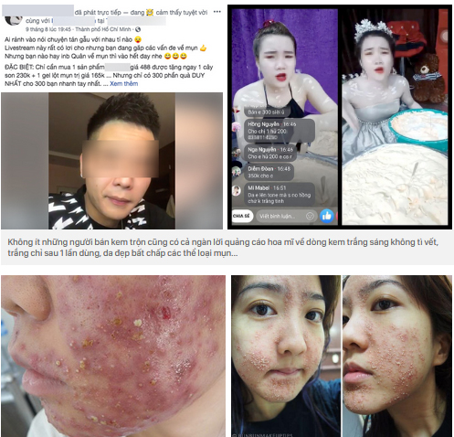 Thái Lan đang lan truyền hộp kem tẩy trắng da: Biến da đen thành da như Cương Thi, trắng đến mức ám ảnh-5