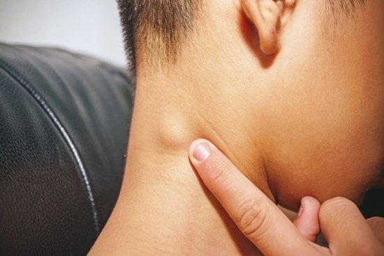 Buổi sáng thức dậy thấy trên cổ xuất hiện một hạch nhỏ, mềm, ấn đau nhẹ thì hãy đi khám ngay vì có thể là dấu hiệu của vài bệnh ung thư