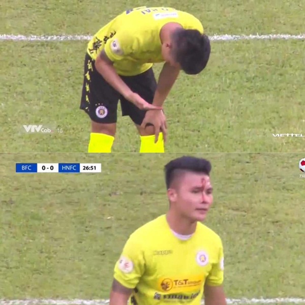 Quang Hải chảy nhiều máu sau khi bị gầm giày đạp thẳng vào mặt, phải băng trắng đầu để tiếp tục thi đấu-3