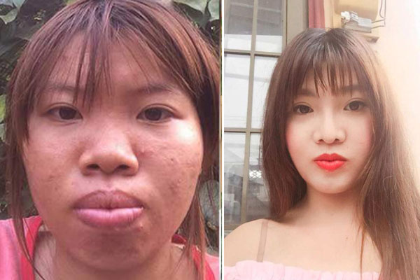 Sau nhiều năm dao kéo, Phượng Thị Nở đăng đàn chuyện bị chế giễu bởi quá khứ kém xinh-12