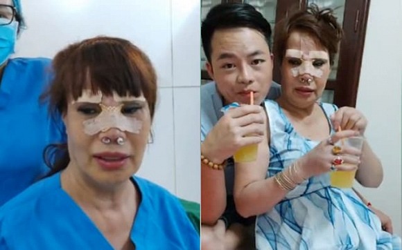 Tỉnh dậy sau ca dao kéo lần thứ N, cô dâu 63 tuổi tiết lộ sợ chết trên bàn mổ-4